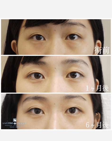 しわ・たるみイメージ